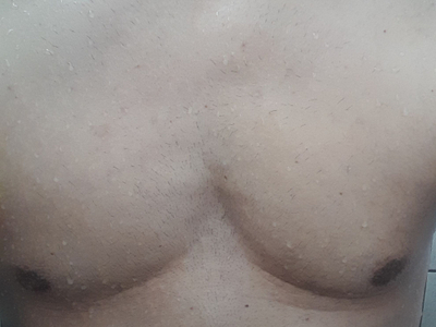 Benom69