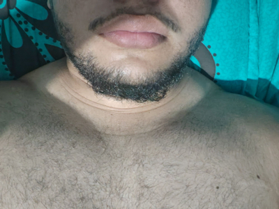 Chinocor2